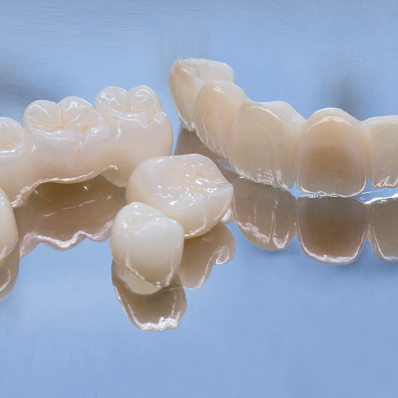 Dental Crowns