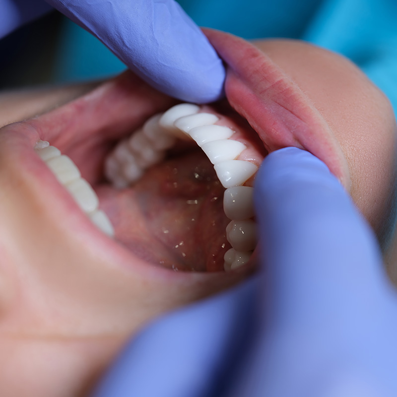 Dentist Looking at Patient's Teeth